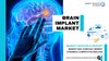 Brain Implant Market Research and Analysis